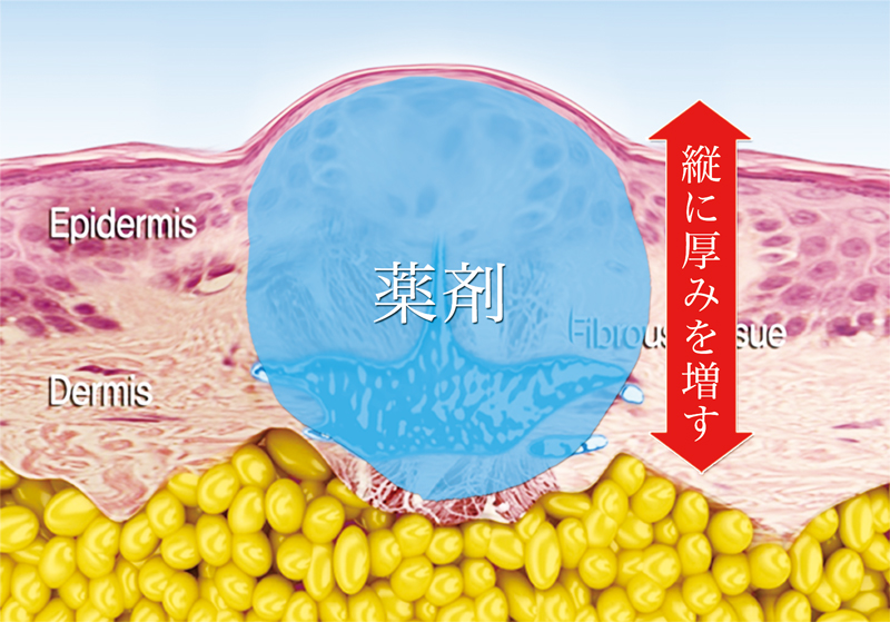 薬剤注入後