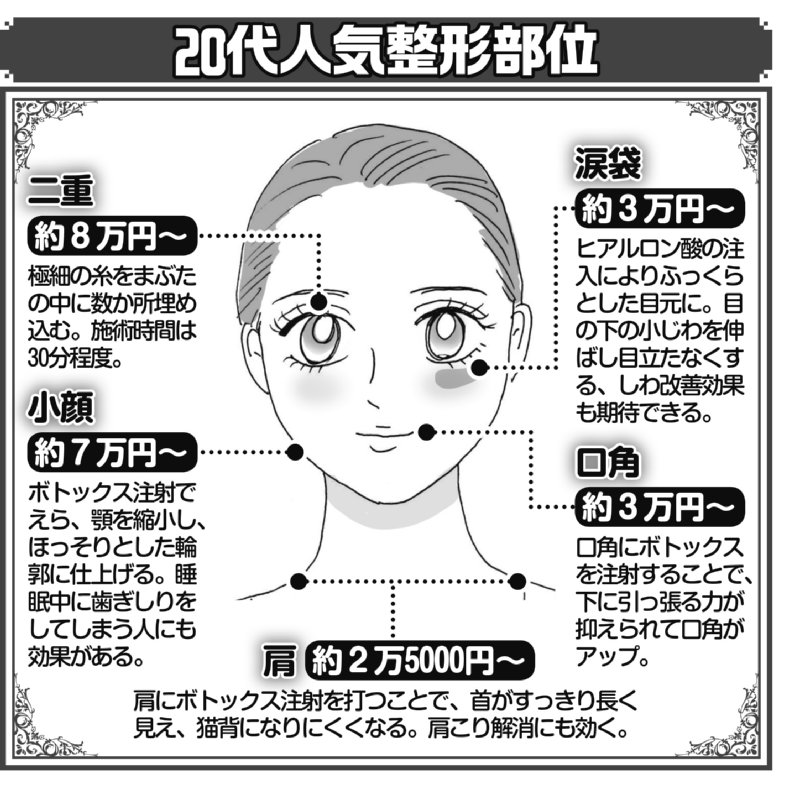 20代の人気整形部位を示した説明イラスト