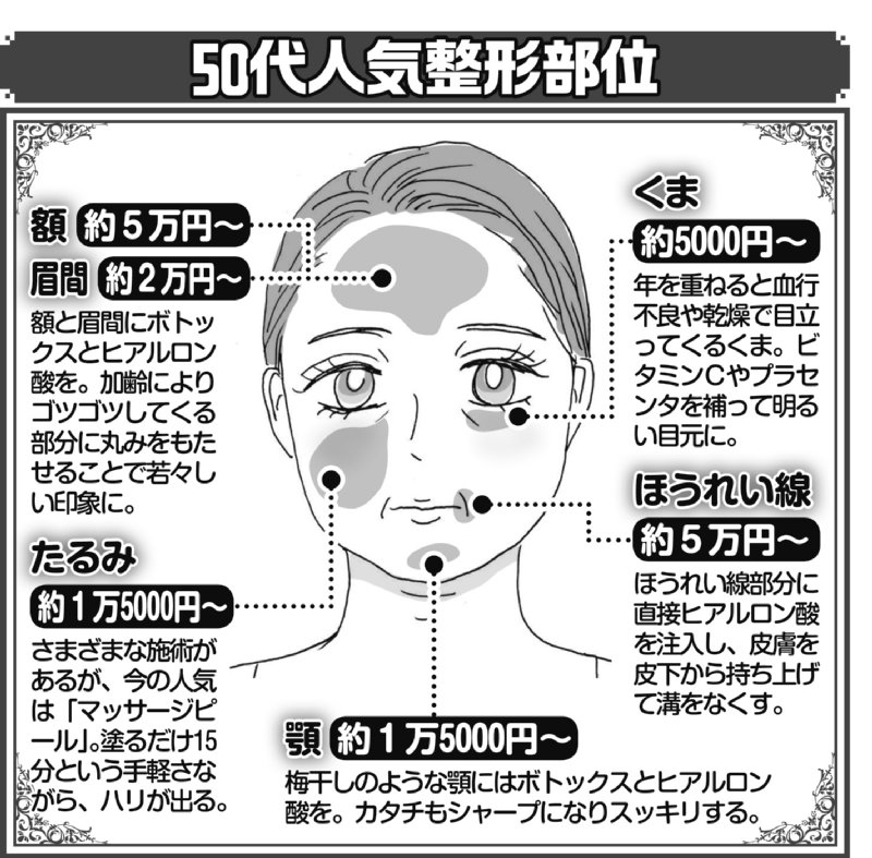 50代の人気整形部位を示した説明イラスト