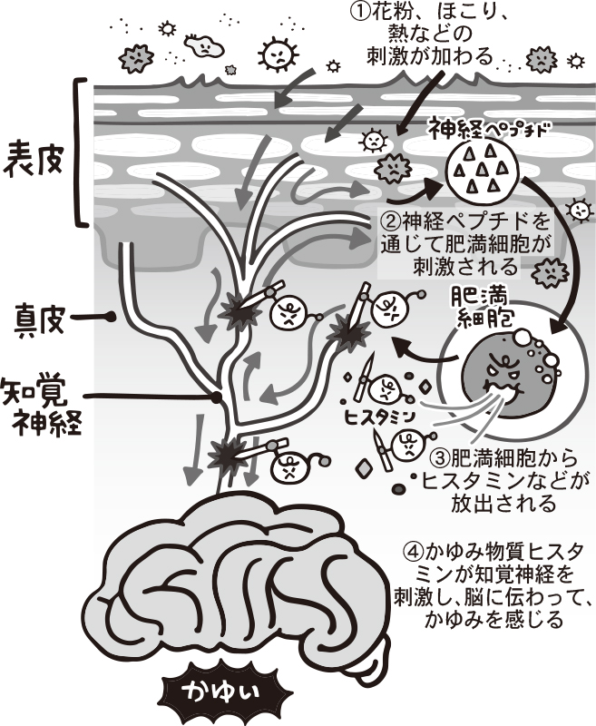 かゆみのメカニズムを図解