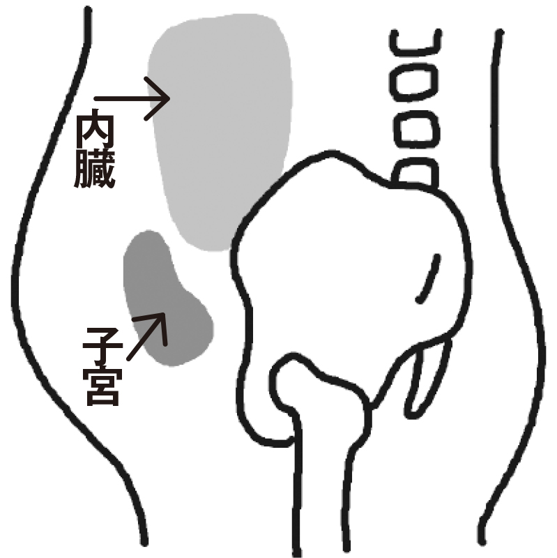 骨盤がゆがんで開くと、内臓を支えられなくなり、内臓とその下にある子宮が下がり、前に押し出されるため、お腹が出る。