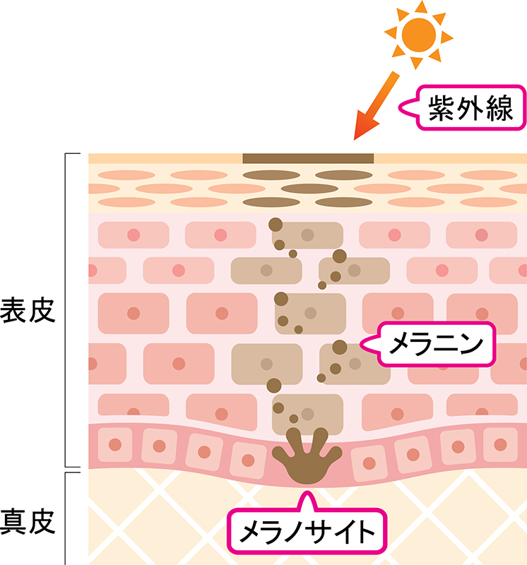 シミができるメカニズム図解