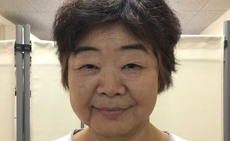 62歳オバ記者、カリスマ鍼灸師との出会いで顔が激変!?知人も驚いた