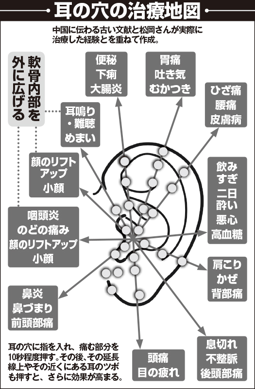 耳のツボとそこに呼応する体の不調を表した図解イラスト