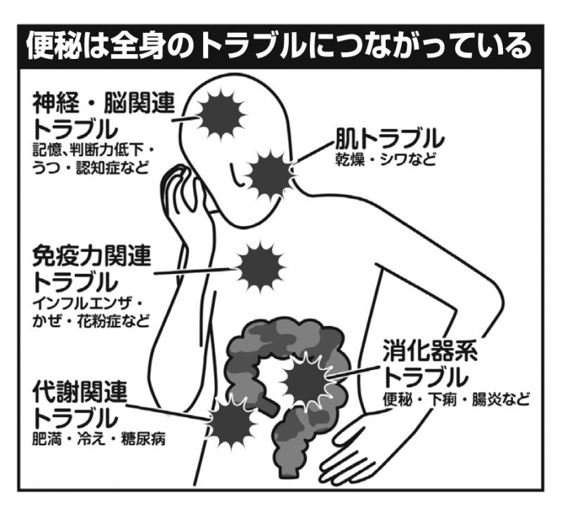 便秘が与える全身へのトラブルを図解したイラスト