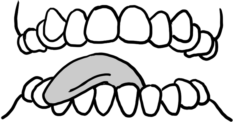 舌を伸ばして歯茎の表面をなぞる