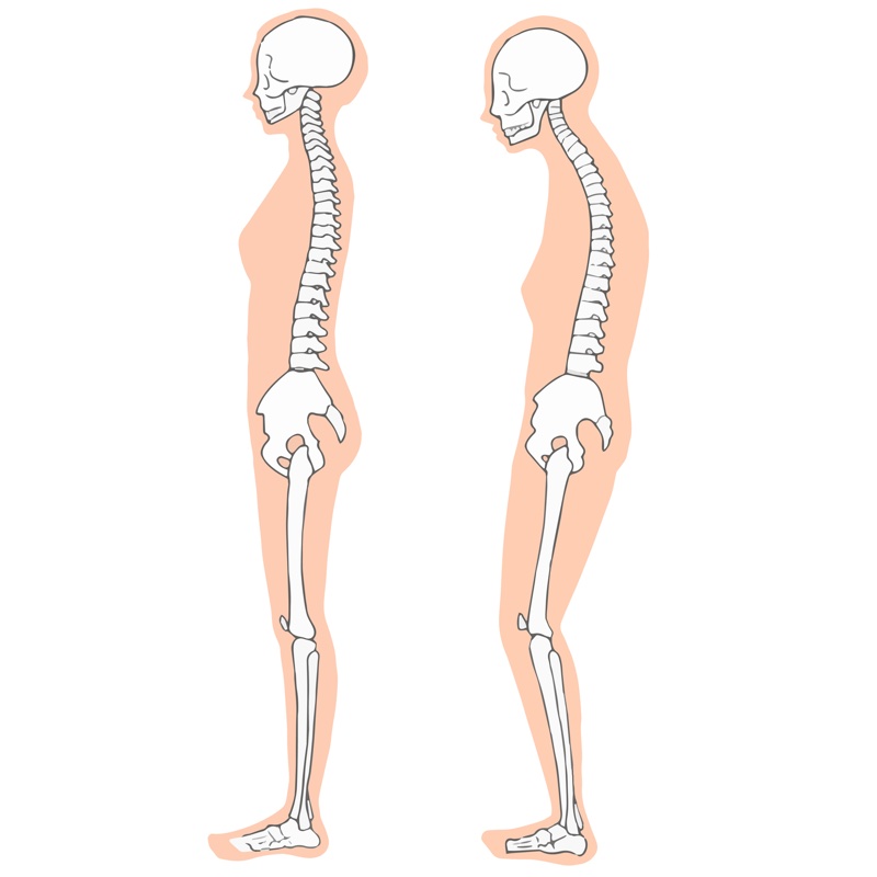 いい姿勢と悪い姿勢を骨で表したイラスト