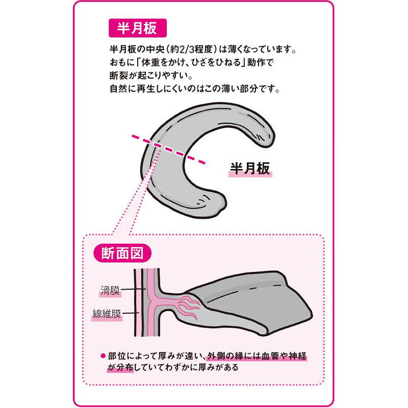 半月板とは（『痛みが消えてずっと歩ける 100年ひざ』より）