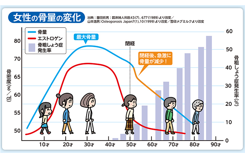 女性の骨量の変化を示したグラフ