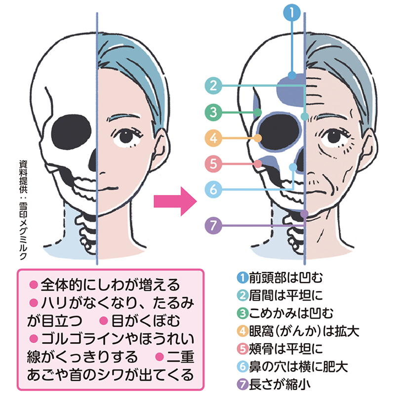 骨としわやたるみの関係性を示したイラスト図