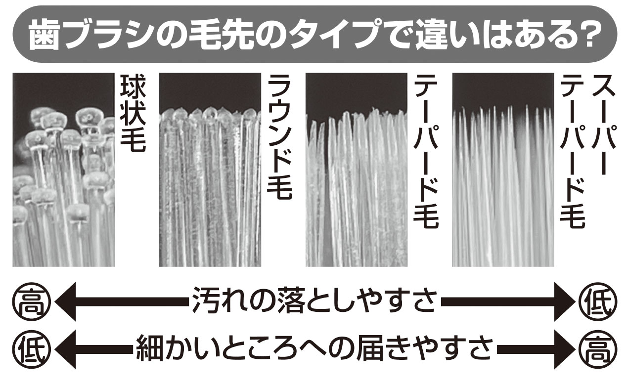 歯ブラシの毛先のタイプ