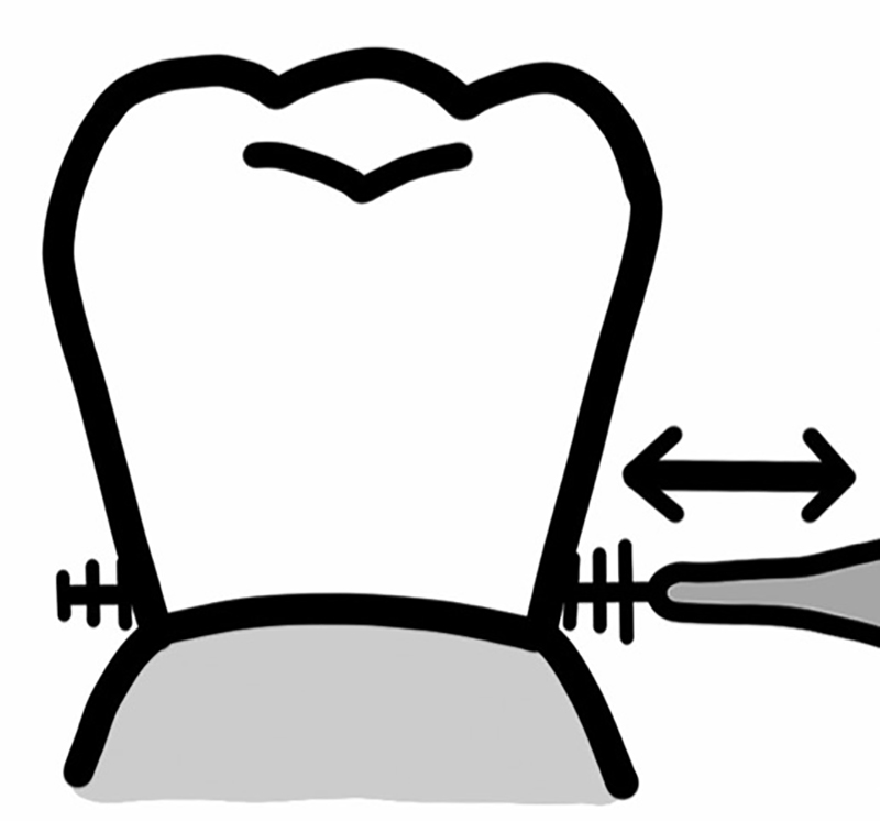 歯間ブラシの動かし方（イラスト／うえだのぶ）