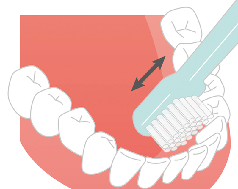 前歯の裏はかき出すようにタテにみがく（イラスト／Kogome／PIXTA）