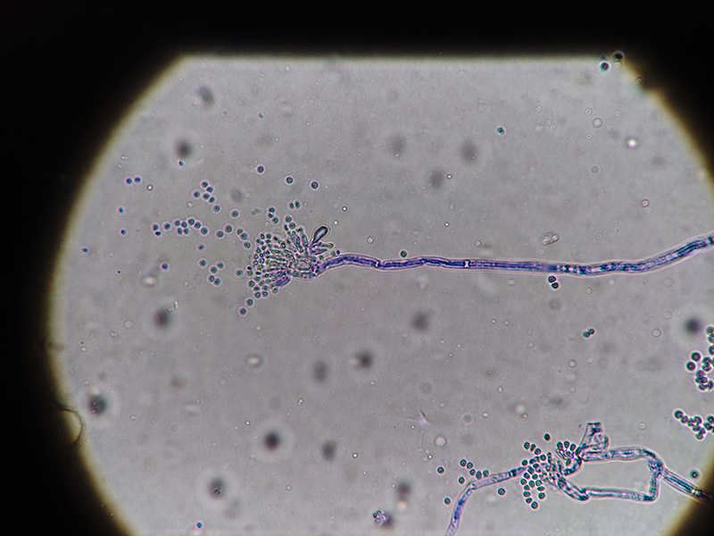 カビは腸壁を溶かしながら、ツタのように増殖する（写真／PIXTA）