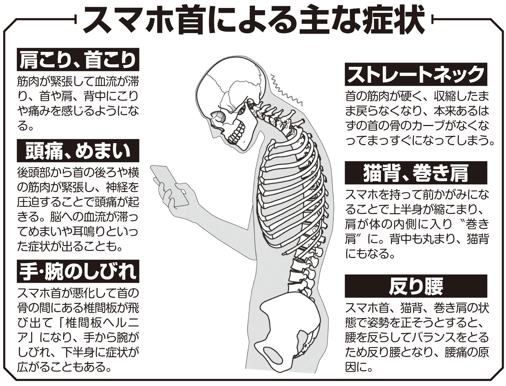 スマホ首による主な症状（イラスト／斉藤ヨーコ）