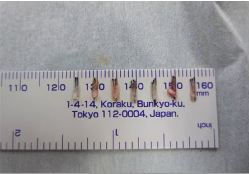 【2】毛を調整（株分け）する（写真／湘南AGAクリニック）