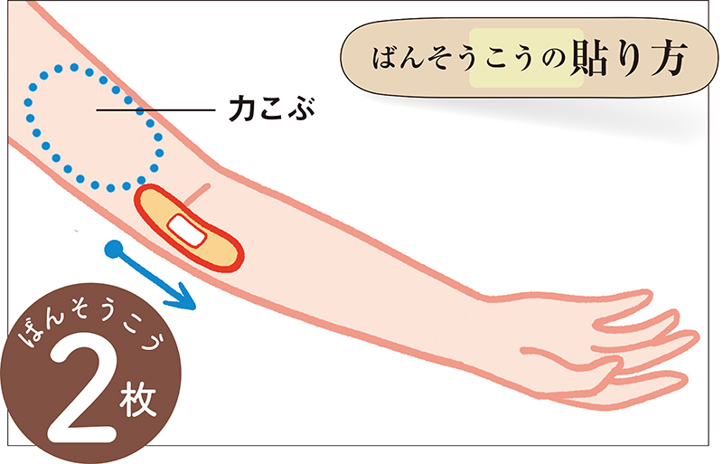 ばんそうこうの貼り方　※右腕のひじ内側の図