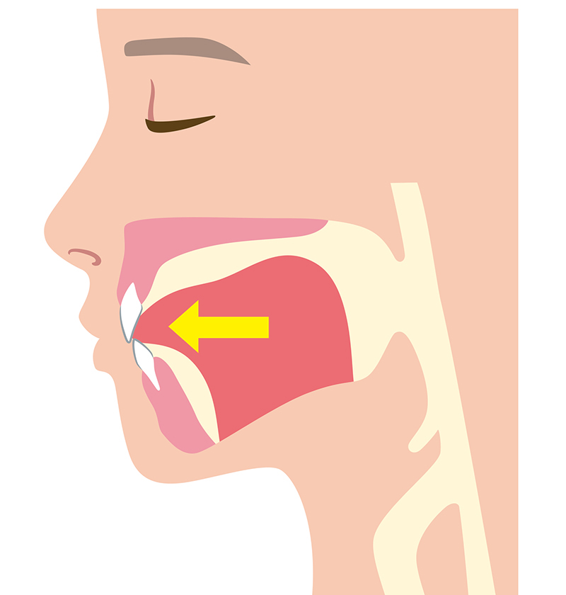 舌が下がっている状態　舌が上あごに接していない状態