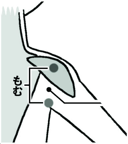 二の腕のゴリッとしたところの説明イラスト