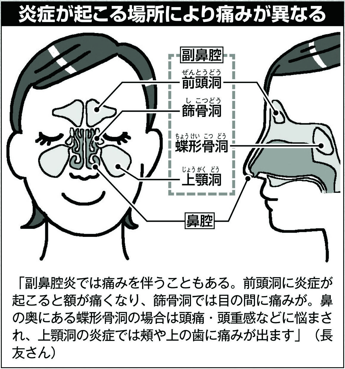 炎症が起こる場所により痛みが異なる