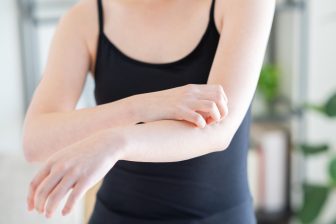 あせも、日焼け、乾燥、虫刺され【夏のかゆみ対策】30選を専門医がアドバイス！「日焼けは炎症＆乾燥のWダメージがかゆみを呼ぶ」