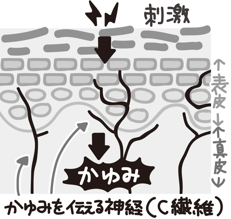 かゆみを強く感じる目なニズム