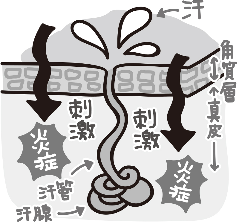 かゆみや赤みの原因