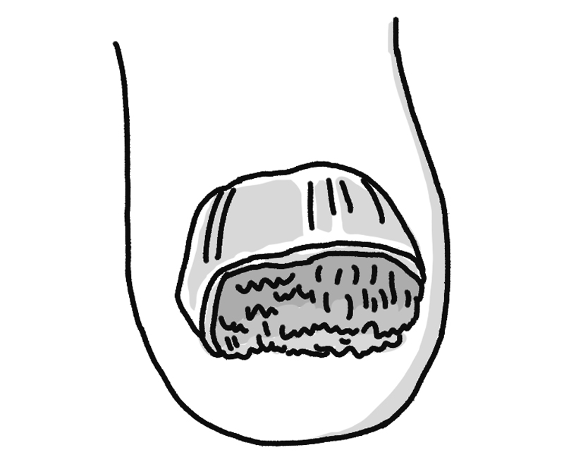 爪の一部に白や緑に変色した箇所がある