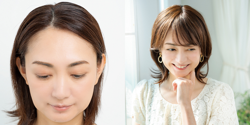 ビフォー（左）、アフター（右）