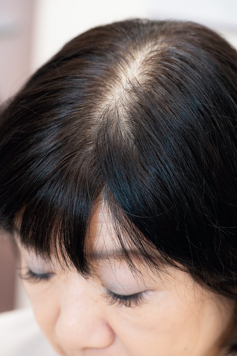 山田美保子さんの頭頂部