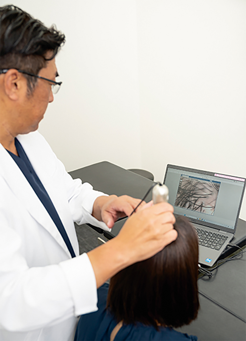 クリニックではマイクロスコープで頭皮の状態が確認できる