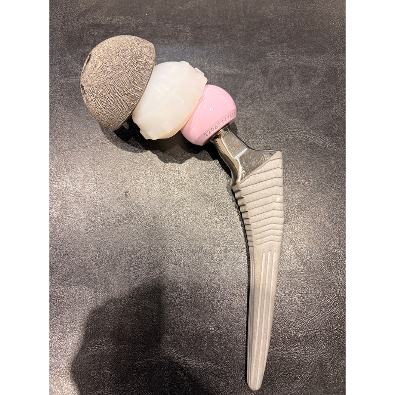 人工股関節は4つのパーツから成り、それらが一体化する。カップやステムはチタン合金、ヘッドはセラミック、ライナーは1年に0.1mm以下しか摩耗しない高性能ポリエチレン製が一般的だ