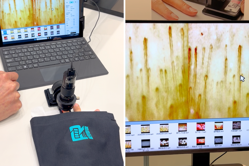 メディヒールを手の甲に当てた時に、血流が早くなったのを変化を見る様子を見える化した「血流スコープ」体験