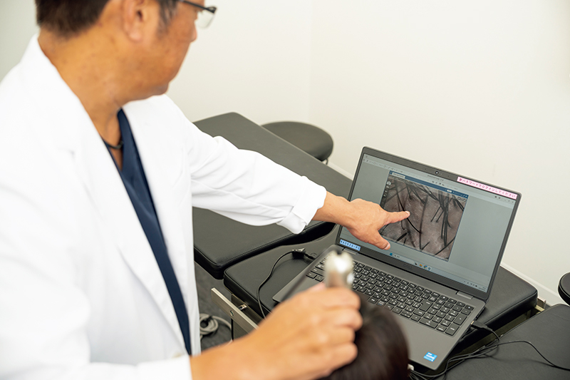 マイクロスコープで頭皮をチェック