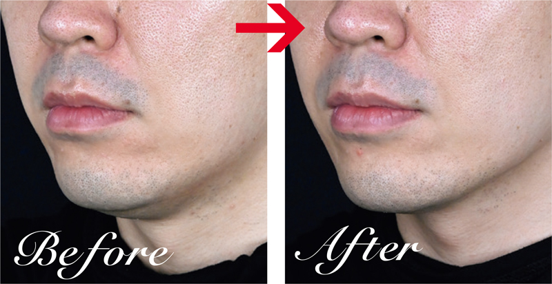 ザーフのビフォーアフター