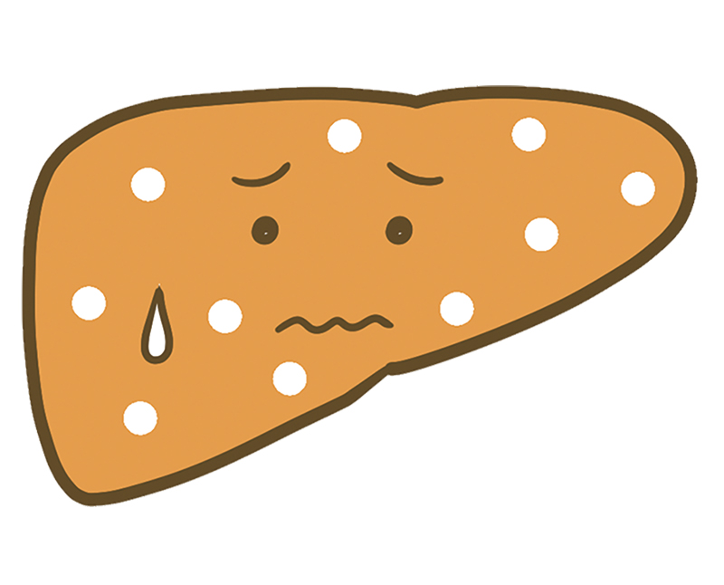 脂肪肝の場合（イラスト／成瀬 瞳）