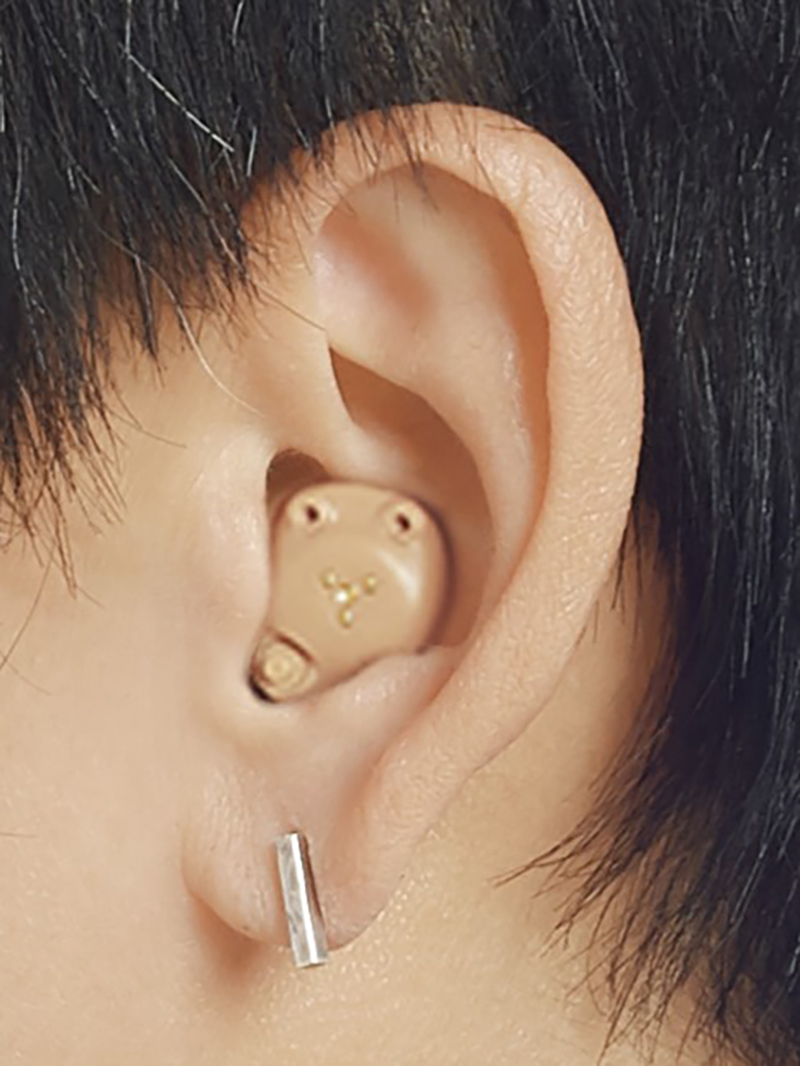 耳穴型