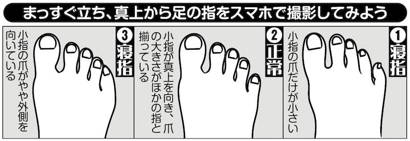 まっすぐ立ち、真上から足の指をスマホで撮影してみよう（イラスト／ふじいまさこ）