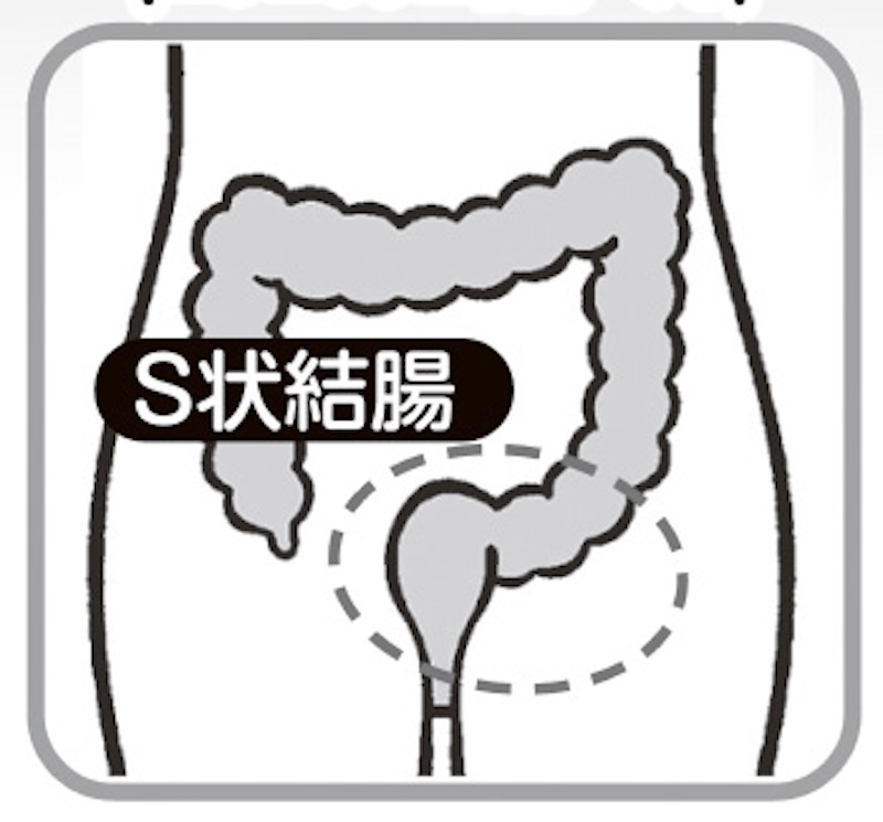 ココに効く！（イラスト／斉藤ヨーコ）