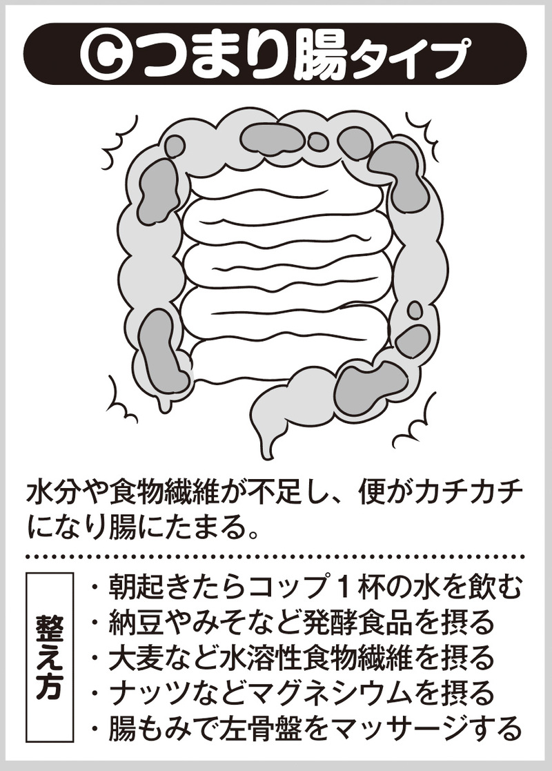 つまり腸タイプ（イラスト／藤井昌子）