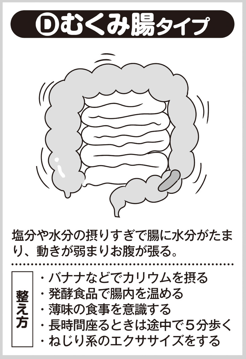 むくみ腸タイプ（イラスト／藤井昌子）