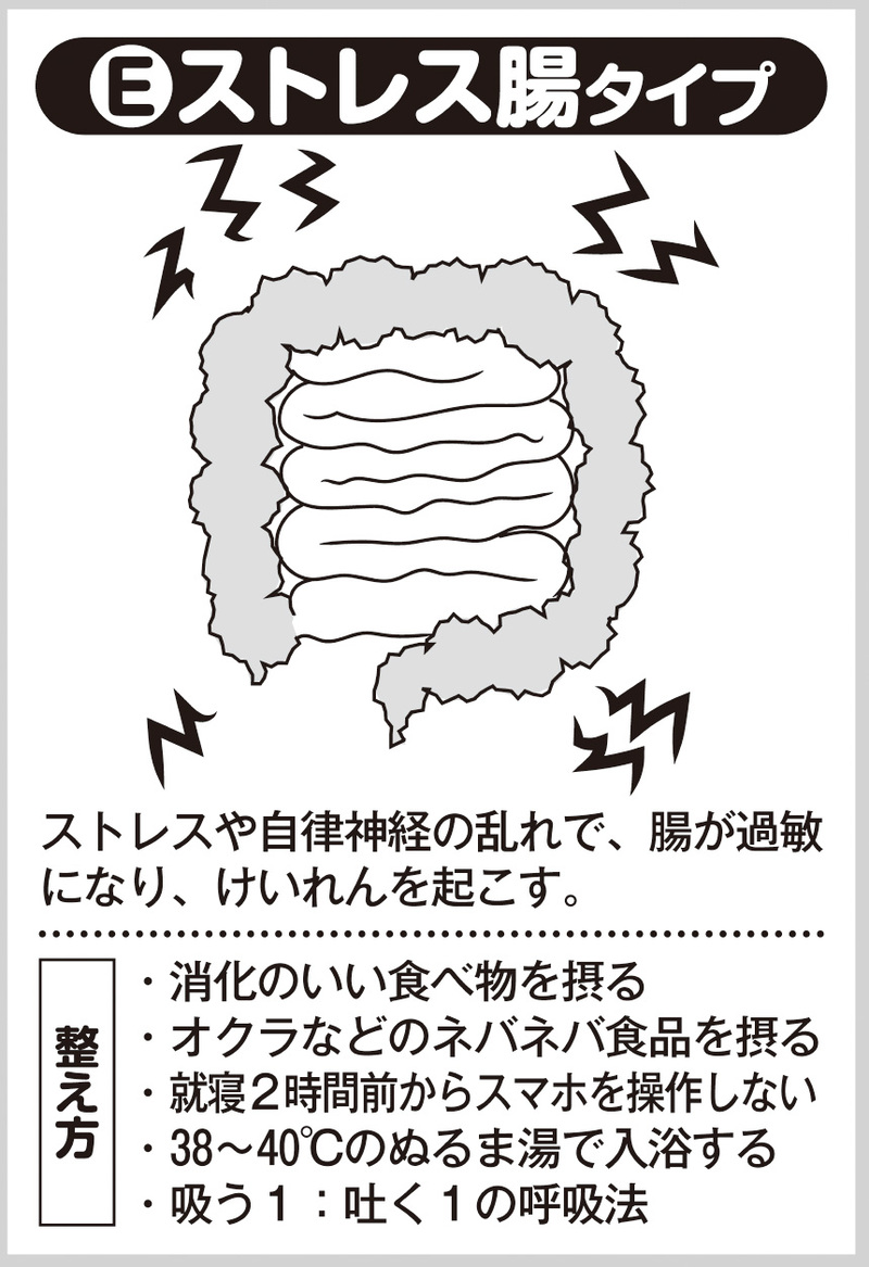 ストレス腸タイプ（イラスト／藤井昌子）
